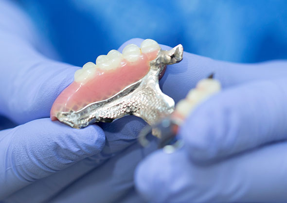partial dentures
