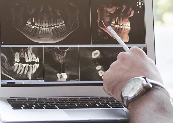 close up of dental x-ray with hand pointing at Temporomandibular joint 