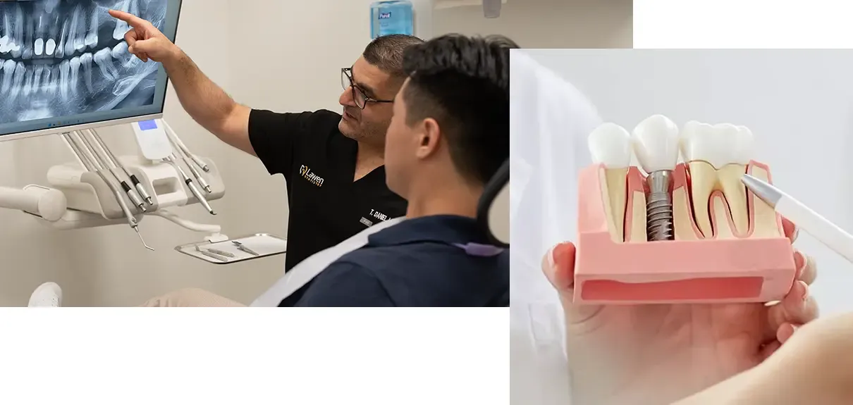 Collage Dr. Lawen showing xRay results to patient and a model of a single tooth dental implant showing a cross section of 3 teeth