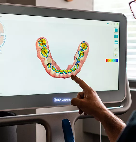 Itero Scan results in the Spring Garden location