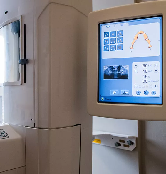 OP300 3D-XRay Machine with Panoramic xray visible on the screen