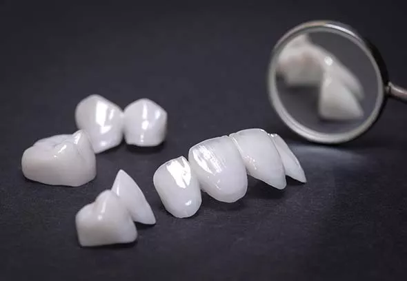Close up of dental veneers and caps on a black background
