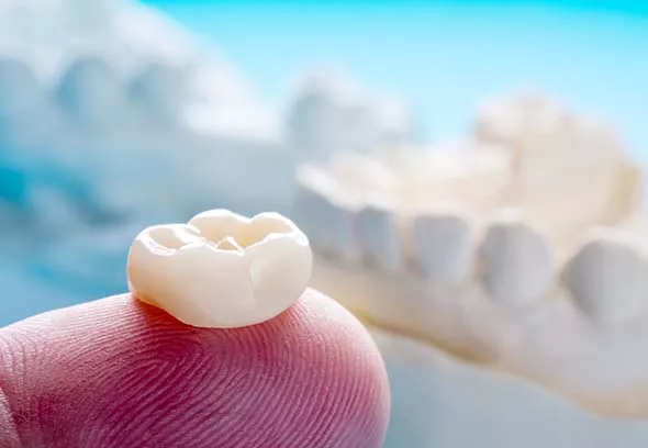 close up of a dental crown with tooth models in the background